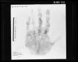 Photograph: Fingerprint Card: Lee Harvey Oswald, Left Hand
