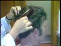 Primary view of [News Clip: Hair implants]