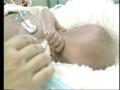 Video: [News Clip: Baby herpes]
