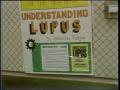 Video: [News Clip: Lupus]