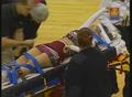 Primary view of [News Clip: Cheerleading accident]