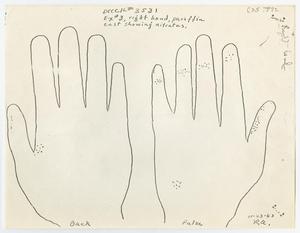 [Lab Report with Nitrate Evaluation of Hand #2]