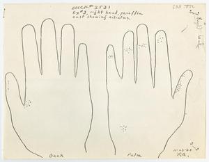 [Lab Report with Nitrate Evaluation of Hand #1]