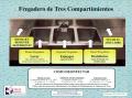 Thumbnail image of item number 1 in: 'Fregadero de Tres Compartimientos'.